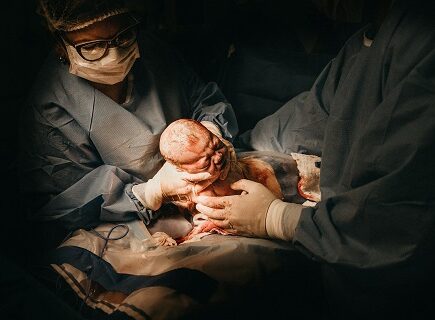 cesarean-delivery